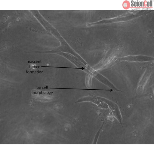 3D Embedded Tubule Formation Kit